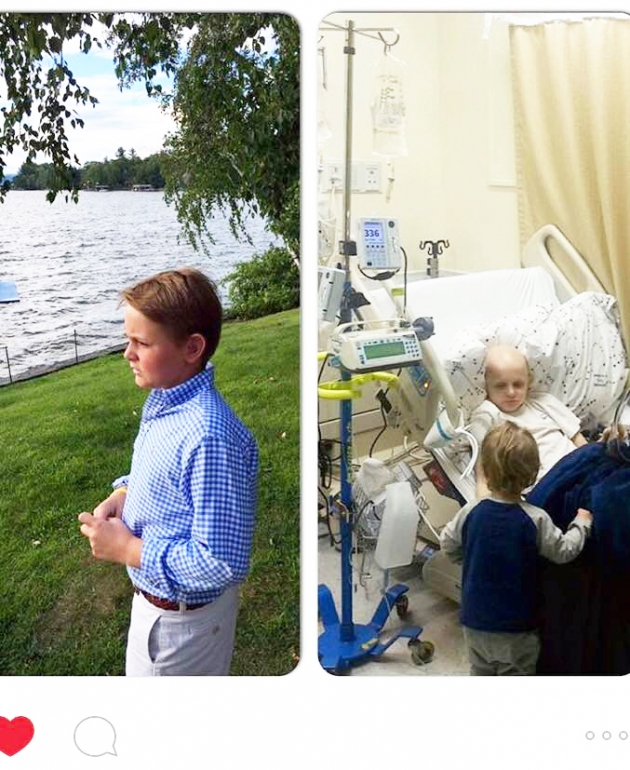 Left: Clarkie Carroll, today. Right: Clarkie being treated for bone cancer 18 months ago.