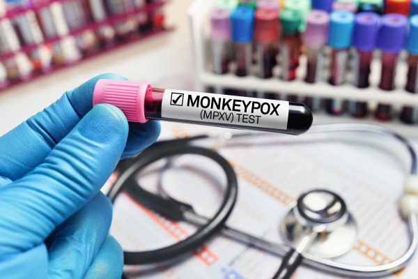 Monkeypox: Are We Prepared?