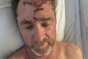 Saratoga Man Survives Plane Crash